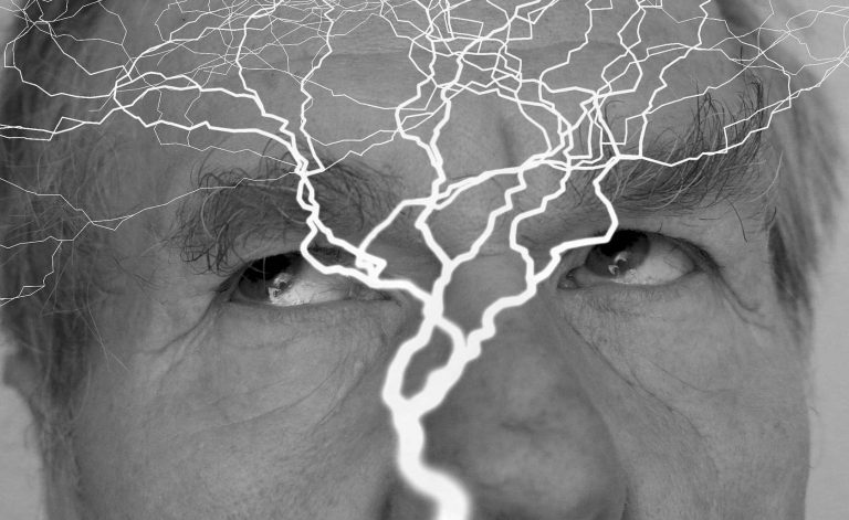 Cbd et épilepsie