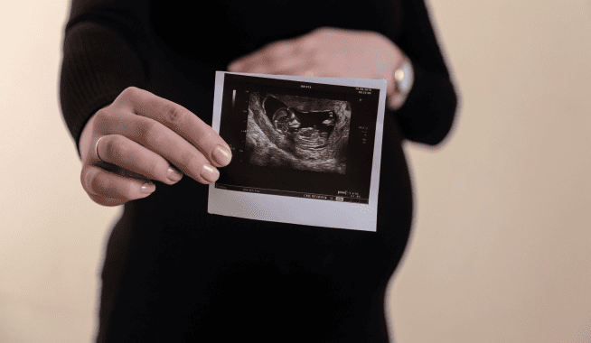 le cannabidiol et la grossesse, est-ce que c'est compatible ?